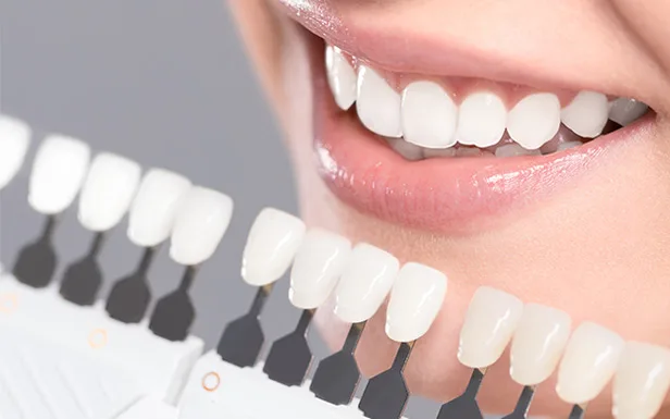 Blanqueamiento Dental