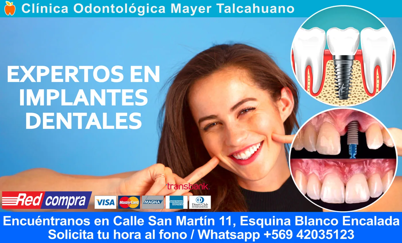 Endodoncia profesional